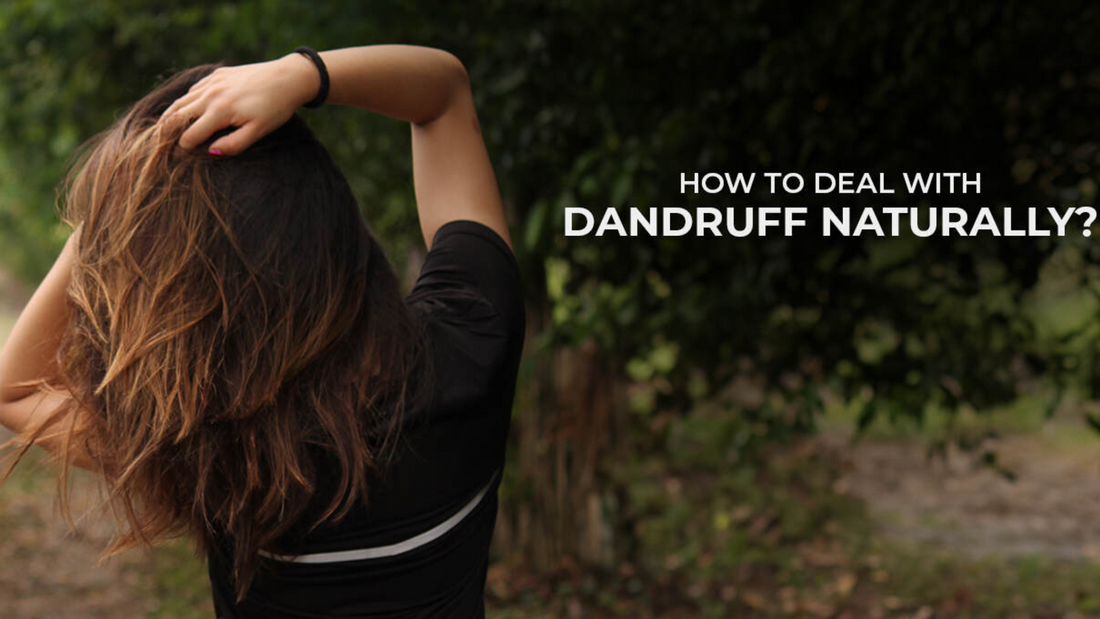 How to Deal with Dandruff Naturally