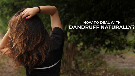 How to Deal with Dandruff Naturally
